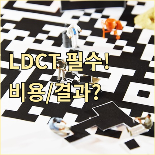 폐암 LDCT 검사 과정, 비용, 결과 확인: 자주 묻는 질문 총정리