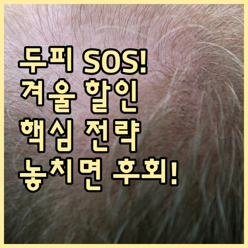 겨울 두피 스케일링 연말 할인, 혜택 시기부터 관리 전략까지 총정리