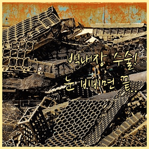 백내장 수술 후 주의사항 | 눈 비비기 금지 및 시기별 활동 제한 요약