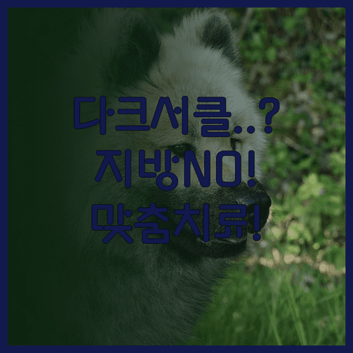 다크서클 종류에 따른 맞춤 치료, 지방 재배치가 답이 아닌 경우