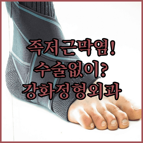 족저근막염 증상과 비수술 치료 | 강화군 정형외과 추천 병원 목록