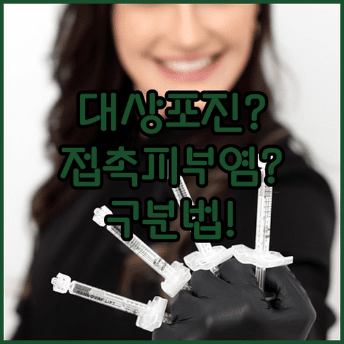대상포진과 접촉성 피부염의 증상 차이와 구분법